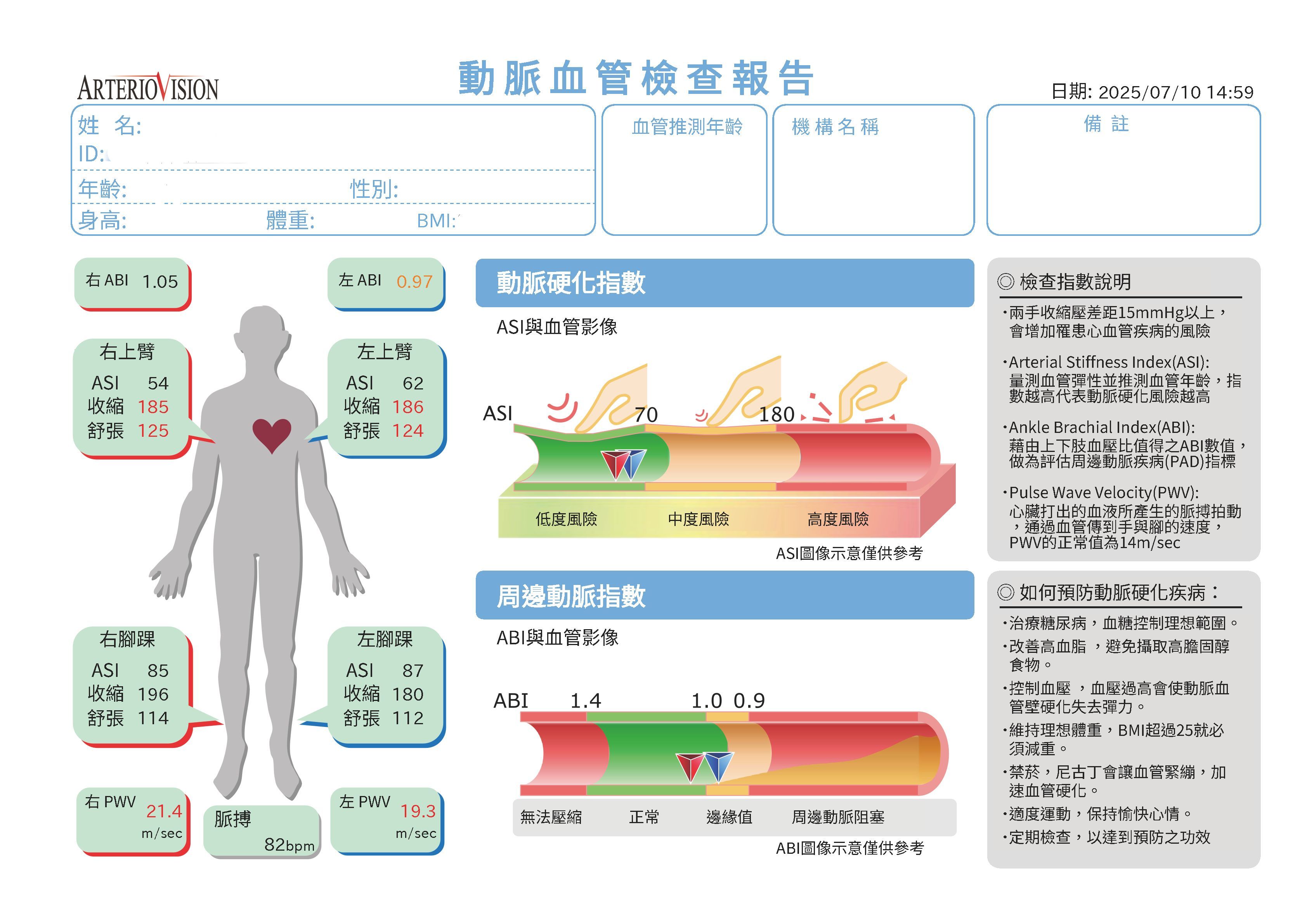  ABI檢測只需要約15分鐘。 操作時會同時測量手腳四肢的血壓，過程如同測量血壓，不會有疼痛感。 