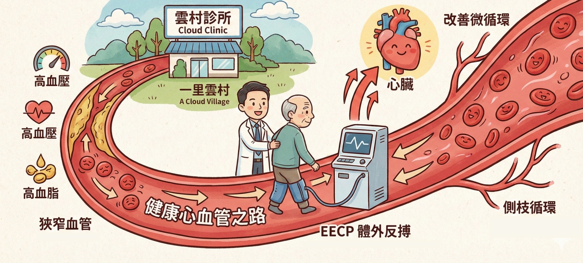 EECP 體外反搏：血管的被動運動 讓雲村診所幫助你